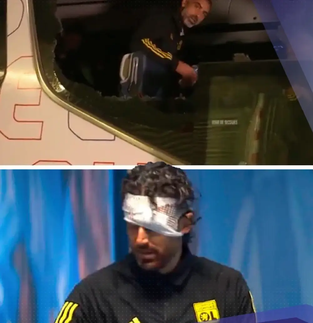 Lyon coach Fabio Grosso suffered a head wound